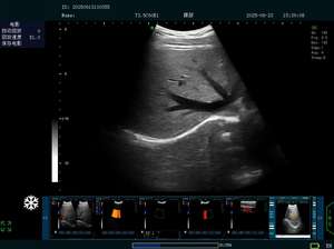 DYX Hoogwaardige draagbare veterinaire echografie <span class=keywords><strong>Doppler</strong></span>-apparaat Prijs voor dieren - Product Image 3