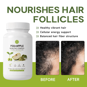 Tabletas Herbales de Biotina para el Crecimiento del Cabello, <span class=keywords><strong>Anticaída</strong></span> y Control de la Caída del Cabello, para Adultos, 60 Unidades, Personalización Disponible - Product Image 1