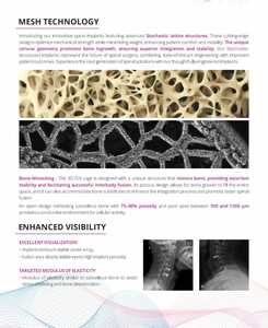 3D FLX PLIF FUSION CAGE-Instrumento quirúrgico de primera calidad para cirugía ortopédica - Product Image 6