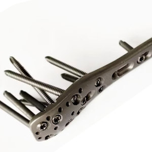 Rétracteur manuel Norfolk Norwich de qualité supérieure en acier inoxydable robuste, cadre extra-résistant, chirurgie générale - Product Image 5