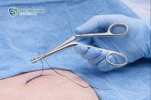 Pinzas para Oído Hartmann-Noyes de Acero Inoxidable, Pinzas Tipo Cocodrilo para Oído, para la Eliminación de Polipos y Cuerpos Extraños del Oído - Product Image 5