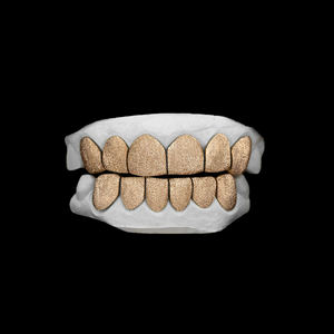 Grillz personnalisé en or texturé taille diamant pour les dents supérieures, fabriqué à la main, 6 dents croisées, 10K - Product Image 1