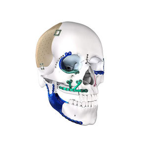 ชุดศัลยกรรมตกแต่งหน้าท้องอุปกรณ์ศัลยกรรมพลาสติก CE ได้รับการรับรองจาก2025สินค้าใหม่เยอรมัน - Product Image 4