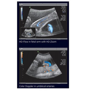 Appareil d'échographie GE Voluson 730 d'occasion, OEM/ODM, portable, pour obstétrique/gynécologie et imagerie générale - Product Image 3