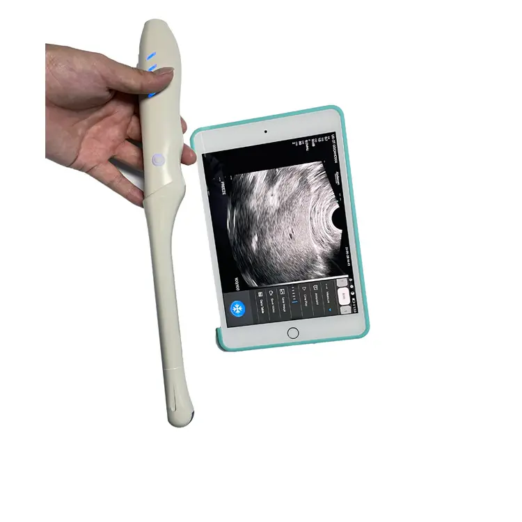 Medical Women Examination Endovaginal Scanner Wireless Transvaginal Color Doppler Ultrasound Probe