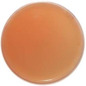 Tùy chỉnh bacillus cereus (<span class=keywords><strong>myp</strong></span>) <span class=keywords><strong>Agar</strong></span> PP chất liệu OEM hỗ trợ - Product Image 1
