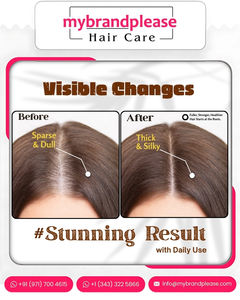 Produits de soin des cheveux Huile capillaire ayurvédique au romarin pour une croissance des cheveux plus rapide OEM ODM Soins capillaires Marque privée Formule personnalisée - Product Image 2