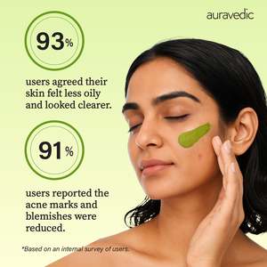 Mascarilla Facial Herbal para Eliminar el Acné en Crema, Tratamiento Natural para el Acné - Product Image 6