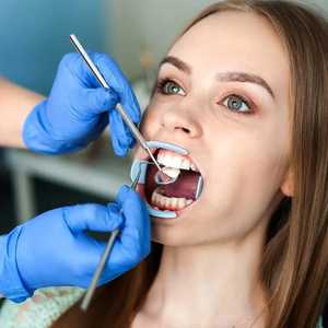 Juego de Instrumentos dentales desechables, espejo dental relajante, espejo de boca intraoral dental desechable de plástico - Product Image 4