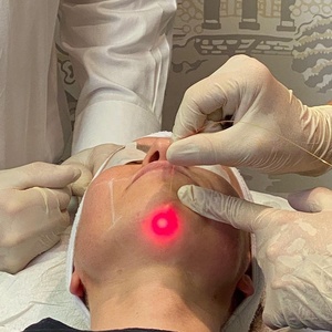 1470nm 980nm endolift laselifting endolifting cho mặt và cơ thể lipolysis <span class=keywords><strong>liposuction</strong></span> chất béo lipolysis chất béo giảm - Product Image 4