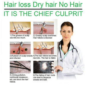 Sérum germinatif aux herbes A163ser 7 jours pour la repousse des cheveux, traitements capillaires haut de gamme - Product Image 3