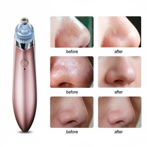 Nettoyeur de pores électrique USB rechargeable, 4 têtes, éliminateur de points noirs, appareil de lifting du visage noir, aspiration des pores, nettoyage des pores pour femmes - Product Image 4