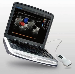 MEILLEURE OFFRE DE GROS ET LIVRAISON RAPIDE Échographe Doppler Couleur Chison Sonobook 9 avec 3 sondes à vendre - Product Image 1
