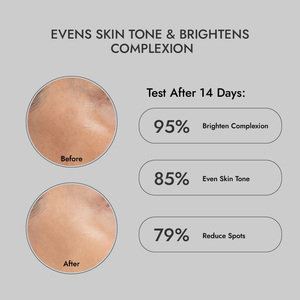 Premium 50ml Esencia blanqueadora de la piel Ayuda a iluminar Aclarar y rejuvenecer su piel - Product Image 5