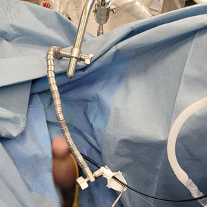 เครื่องมือผ่าตัดกระดูกและข้อ ระบบยึดติดปลอกเข้าถึง วัสดุสแตนเลส ได้รับการรับรองมาตรฐาน CE รุ่น SSI-3201 SURGINEXA - Product Image 3