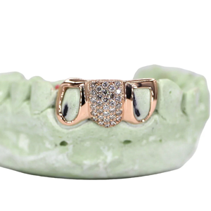 Gril à diamant Moissanite à 1 dent et 2 dents à face ouverte Gril à diamant personnalisé en or rose Grillz à face ouverte Canine avec grille en or massif - Product Image 1