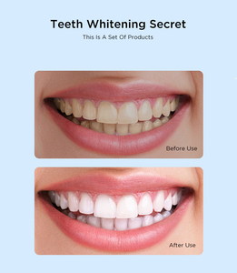 Kit de blanqueamiento dental de marca Premium Dropshipping con luz LED Muestra gratuita Cuidado cosmético de los dientes - Product Image 6