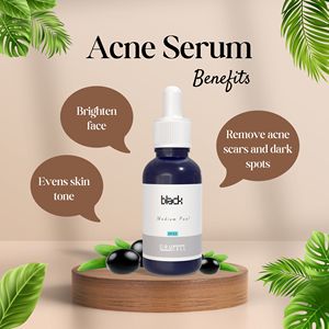 Crucell Black Peel Kit Peel chimique doux pour l'élimination de l'acné et des cicatrices pigmentation Marque privée disponible à usage professionnel - Product Image 3