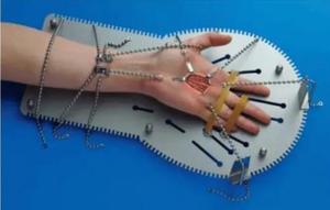 Ensemble de chirurgie de la main Cupper Retractor - Product Image 4