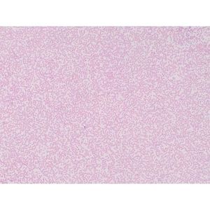 Portaobjetos de microscopio preparados: Frotación de sangre humana normal - Product Image 1