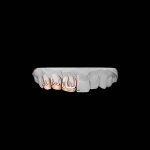 Grillz Flamme en Moissanite Plaqué Or Rose 18K Personnalisé pour Dents Supérieures et Inférieures – Design Unique Effet Feu – Embout Buccal Hip Hop pour Hommes - Product Image 2