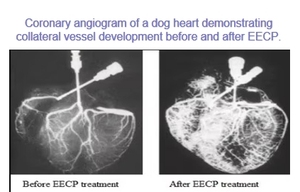 جهاز CE Thai FDA EECP/جهاز علاج القلب الخارجي المضاد لآلام القلب/الذبحة الصدرية الأجهزة الطبية الطبيعية الالتفافية - Product Image 5