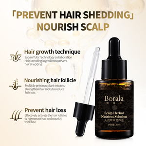 Borala Productos anticaída del cabello Tratamiento de la calvicie Hombres Mujeres Aceite <span class=keywords><strong>para</strong></span> el crecimiento del cabello - Product Image 4