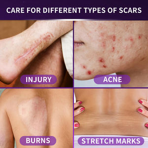 Gel Professionnel de Traitement et Réparation des Cicatrices pour Réduire Rougeurs et Gonflements, Efficace sur les Cicatrices Post-Opératoires, Marques d'Acné et Récupération Post-Césarienne - Product Image 4