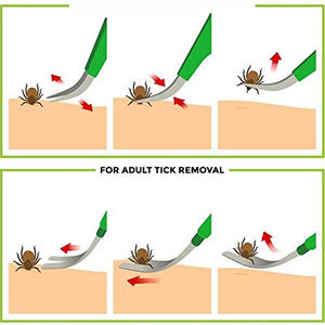 High Quality Manual 2 in 1 Stainless Steel <b>Tick</b> <b>Tweezers</b> Professional <b>Tick</b> Removal Tool for Cats Dogs Pets Pakistani Manufacture - Product Image 5