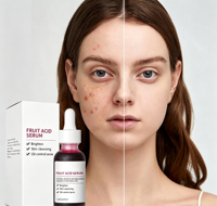 Private Label 30ml Fruitzuur Serum Diepe Peeling Exfoliatie Reinigende Porien Olie Controle Anti Acne Verheldering