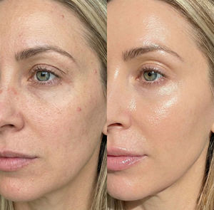 PDRN de ADN de Salmón de Marca Privada 10X Altamente Concentrado, Rejuvenecimiento de la Piel, Blanqueamiento, Cuidado de Arrugas, Péptido de Glutatión, Niacinamida - Product Image 3