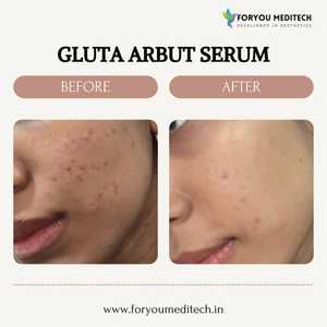 เซรั่มเหลว Dermasky กลูตา arbut ขนาด30มล. เซรั่มบำรุงความงามปรับผิวทุกสภาพผิว - Product Image 3