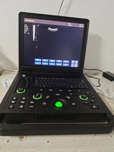 Détecteur d'Ultrasons Vétérinaire Portable VET avec Utilisation Facile pour Chiens/Chats <span class=keywords><strong>et</strong></span> Bétail - Product Image 5