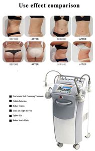 Beauty Legacy Vela Rotation <b>Roller</b> Massage Cellulite Reduction Stretch Marks Body Slimming TighteningLifting Weight Loss Machine - Product Image 5