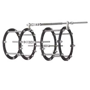 Fijador externo manual de acero para instrumentos quirúrgicos ortopédicos de alargamiento óseo de Pakistán - Product Image 2