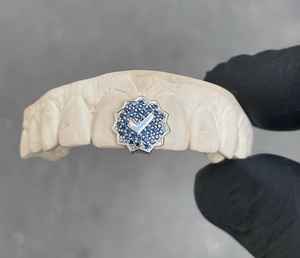 Hip Hop argent glacé Grillz haut bas Zircon cubique Moissanite diamant dents décoration 10k 14k 18k or 925 dents en argent - Product Image 1