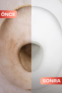 Bathroom <b>Cleaner</b> for Limescale, Rust & Odor Remo 750ml WC-Gel Anti-Rust <b>Acid</b> <b>Toilet</b> <b>Cleaner</b> - Product Image 2