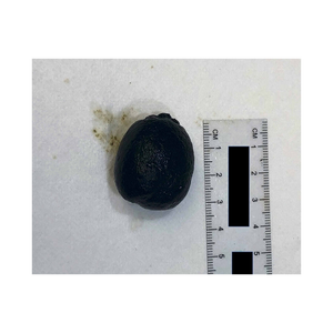 Pierres biliaires en pierre noire à bas prix idéales pour les tests d'extraction et de laboratoire - Product Image 3