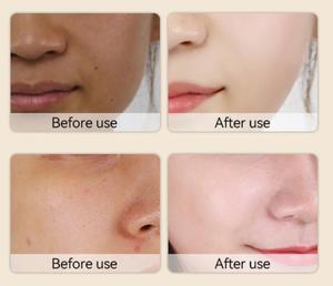 Essence de soin de la peau à base de peptides végétaux et de vitamine C, efficace pour l'élimination des taches de rousseur, du mélasma, des taches brunes et des pigments pour les femmes - Product Image 3