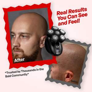 Afeitadora Eléctrica Inalámbrica 5 en 1 para Hombres Calvos, Kit de Aseo Masculino con Carga USB y Cuchilla Rotatoria para Afeitar la Cara - Product Image 1