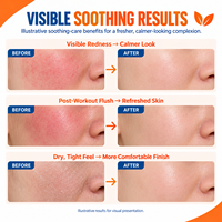 Spray Visage Liquide à l'Acide Hypochloreux OEM ODM Marque Privée SOS Sauvetage Quotidien Brume Apaisante Rafraîchissante Hydratante Soin de la Peau