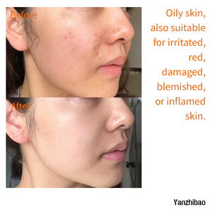 Hamamelis <span class=keywords><strong>Astringente</strong></span> Sin Perfume OEM, Limpia, Tonifica, Calma y Repara, Apto para <span class=keywords><strong>Piel</strong></span> Irritada, Enrojecida y Dañada. - Product Image 3