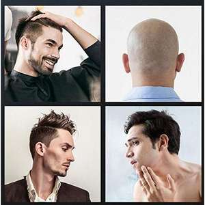 Rasoir rotatif électrique rechargeable à double tête pour hommes, tondeuse à cheveux dorée pour le visage - Product Image 2