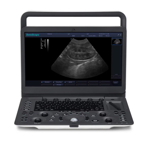 Échographie vétérinaire Doppler couleur Portable Sonoscape E1EXPV avancée pour félin canin bovin équin - Product Image 2