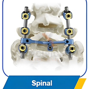 Sistema de fijación externa ortopédica con articulaciones de muñeca Fijador externo Instrumentos quirúrgicos Base de Surgiright - Product Image 2