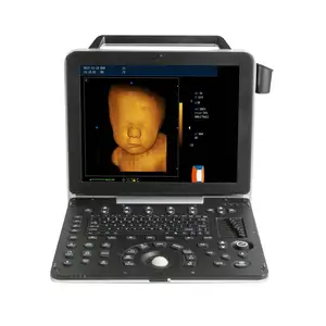 New generation ultrasound, portable 3D 4D Color Doppler ultrasound with super image, Advance Ultrasound