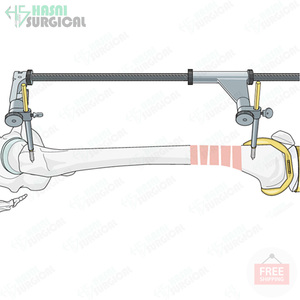 Distractor femoral manual de acero inoxidable más vendido, instrumento quirúrgico médico ortopédico, logotipo y tamaño personalizados - Product Image 3