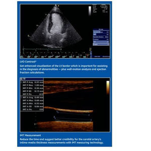Appareil d'échographie GE Vivid S5 d'occasion - Product Image 3