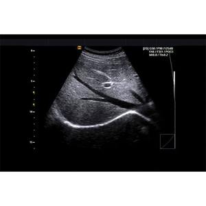 Máquina de Ultrasonido Samsung SonoAce R3 - Product Image 6