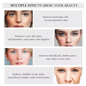 Temizleyici nemlendirici cilt bakımı için 3In 1 elmas mikrodermabrazyon makinesi - Product Image 3
